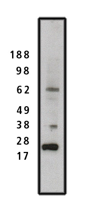 Western blot using SET antibody (Cat. No. X2088P) on HeLa cell lysate (15 µg/lane).  Primary antibody used at 1 µg/ml.  Secondary antibody used at 1:50k dilution.